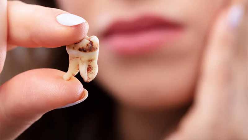 Răng số mấy? Giải mã giấc mơ thấy răng và con số may mắn dễ trúng